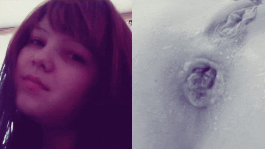 The face of Juicypussy2288 and her anal prolapse.