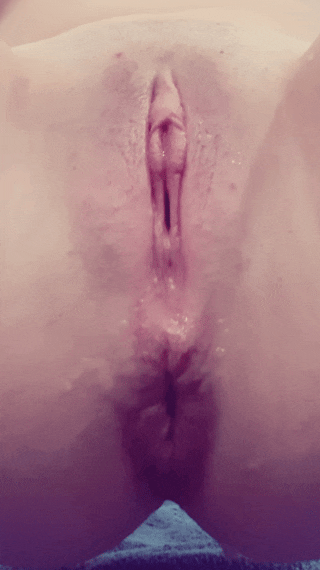The face of Juicypussy2288 and her anal prolapse.