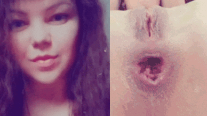 The face of Juicypussy2288 and her anal prolapse.