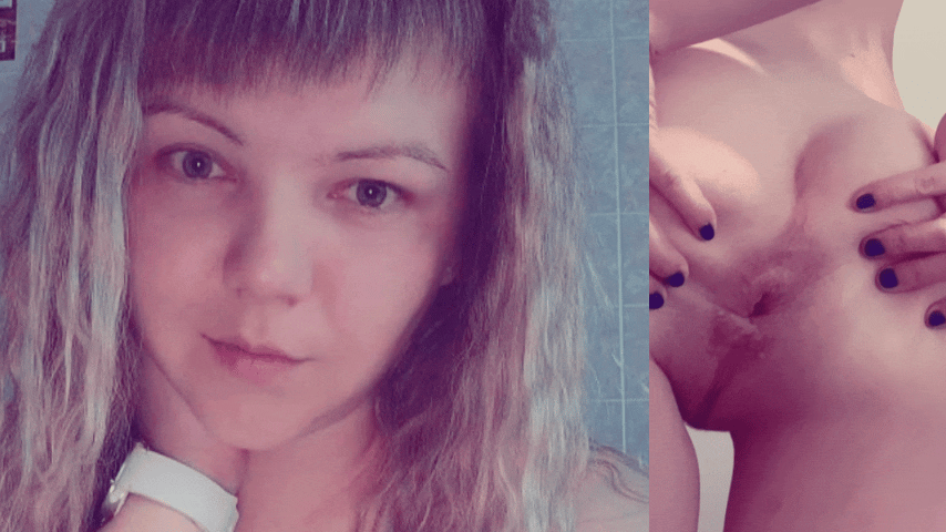 The face of Juicypussy2288 and her anal prolapse.