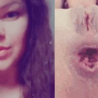 Juicypussy2288's face and her anal prolapse from m...