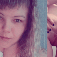 Juicypussy2288's face and her anal prolapse from m...