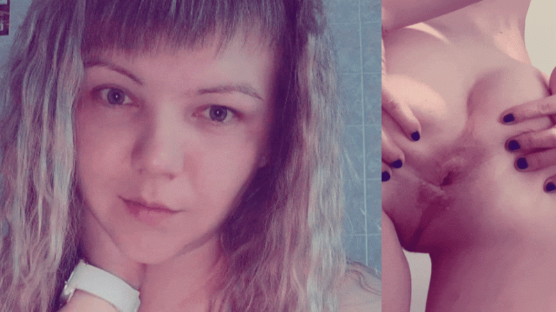 The face of Juicypussy2288 and her anal prolapse.