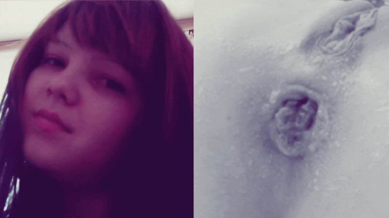 The face of Juicypussy2288 and her anal prolapse.