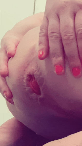 The face of Juicypussy2288 and her anal prolapse.