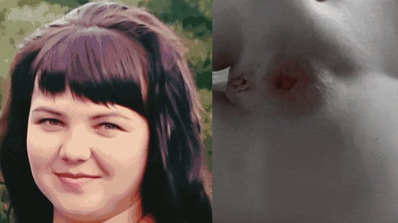 The face of Juicypussy2288 and her anal prolapse.