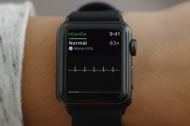 В Apple Watch появятся новые функции, спасающие жизнь